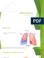 Neumotórax
