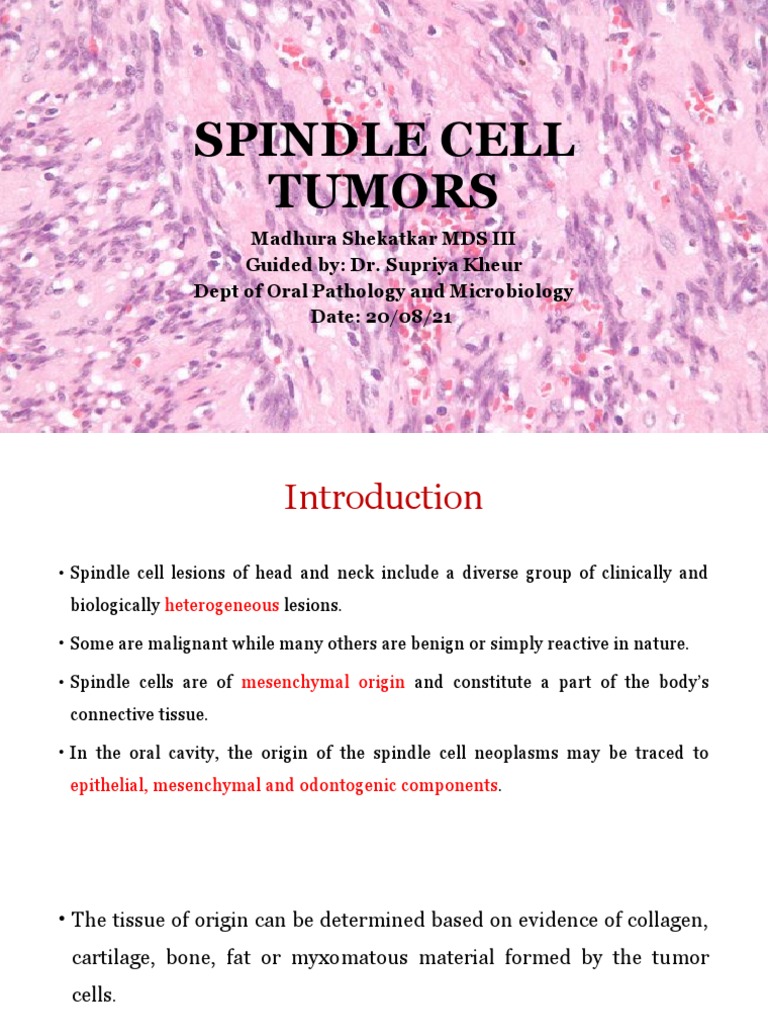 Spindle Cell Tumors PDF Benign Tumor Neoplasms