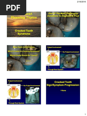 B--Cracked Tooth Syndrome