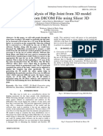 Structural Analysis of Hip Joint From 3D Model Generated From DICOM File Using Slicer 3D