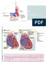 ToF Trikuspid Atresia Trunkus Arteriosus