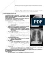 Radiografia de Torax