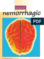 25297449 Haemorrhagic Stroke