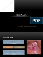 Fisura Anal Corregido