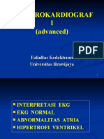 EKG Advanced