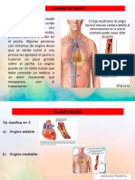 Exposición Angina de Pecho