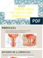 HIPERPLASIA BENIGNA DE PRÓSTATA - Ellison Mendoza Melendez