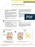 Tips On Access Cavity Preparation.: How To' Technique