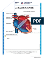 Atrioventricular-Septal-Defect-Avsd-Complete Edit
