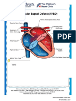 Atrioventricular Spetal Defect Avsd Partial Edit