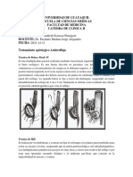 Tratamiento Quirurgico Antireflujo Tarea5