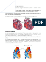 Insuficiencia de La Válvula