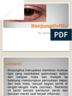 Konjungtivitis