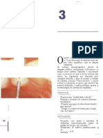 Ajuste As Eficiéncia Processo Qual Faces Oclusais. ' Guichet," Ajuste Comparado