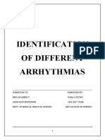 Identification of Different Arrhythmias