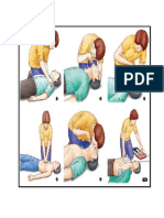 CPR Process