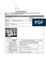 Interpretasi Radiografi Periapikal Posterior RA Kanan (A)