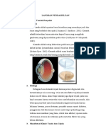 Laporan Pendahuluan Katarak Nuy