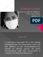 Tuberculosis Max Alarcon