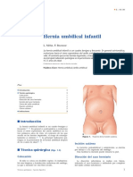 Hernia Umbilical Infantil