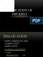 Dislocation of Hip Joint