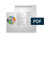 Graficos de Mortalidad Neonatal