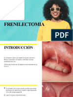 Frenilectomia 