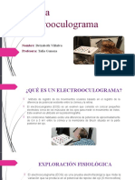 Prueba Electrooculograma