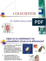 Colelitiasis: causas, síntomas y tratamiento