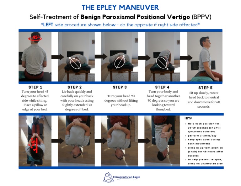 BPPV Self-Treatment Guide: Epley Maneuver | PDF