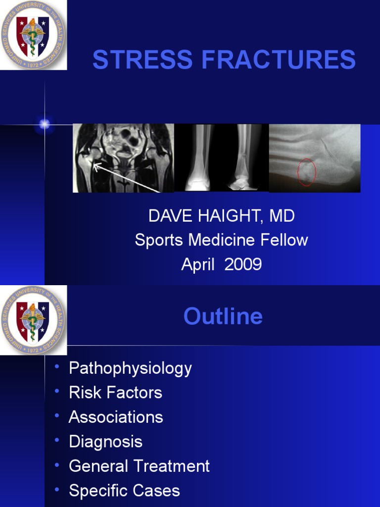 Understanding Stress Fractures in Athletes | PDF | Bone ...