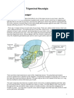 What Is Trigeminal Neuralgia?