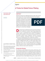 Surgical Tips and Tricks For Distal Femur Plating.2