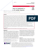 Systematic Review - Cardiac Lipoma