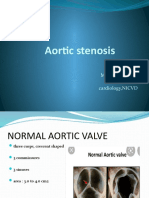 Aortic Stenosis BY ISRAR