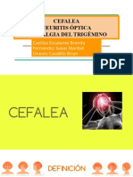 Cefalea Neuritis Neuralgia