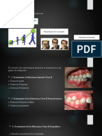 NUEVO Maloclusion Clase !!