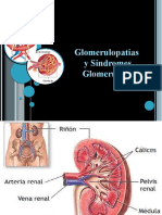 Glomerulopatias y Sindromes Glomerulares: Diagnostico y Tratamiento