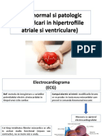 Ecg