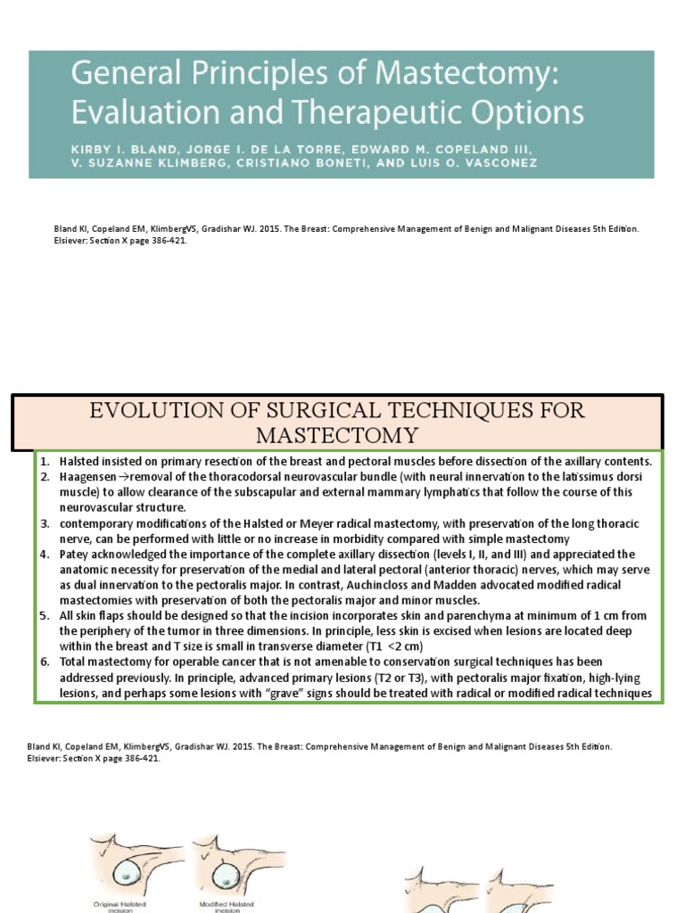 Fmd The Key Factors To Consider Before A Preventive Mastectomy - 4x0mwpq