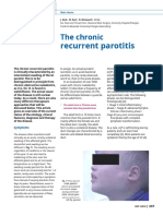 Recurrent Parotitis: The Chronic