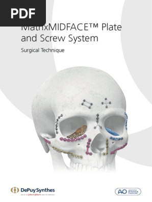 SE 807065ABeng | PDF | Screw | Magnetic Resonance Imaging