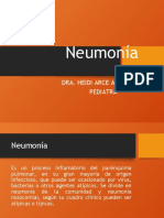 Neumonia