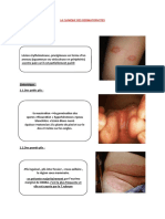 La Clinique Des Dermatophytes