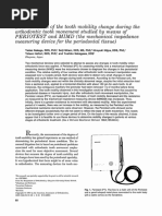 Determination of The Tooth Mobility Change During The Orthodontic Tooth Movement