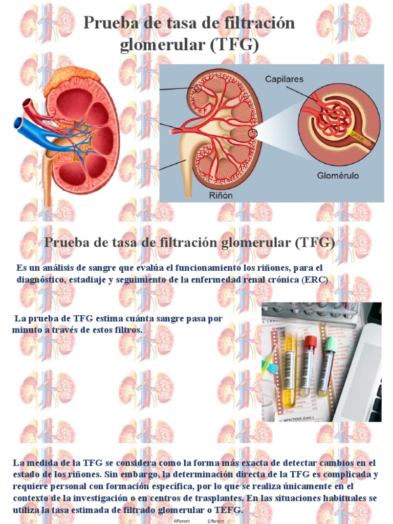 Tasa de Filtración Glomerular PDF