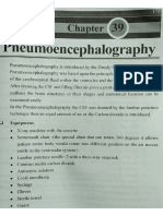 Pneumo-Encephalography by JBD