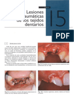 ENDODONCIA CAP XV