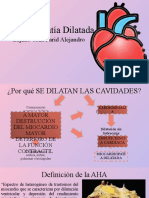 Miocardiopatía Dilatada