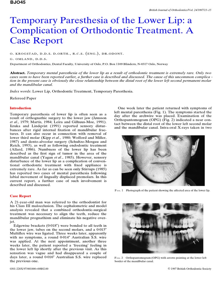 Temporary Paresthesia of The Lower Lip A Complication of Orthodontic Treatment. A Case Report